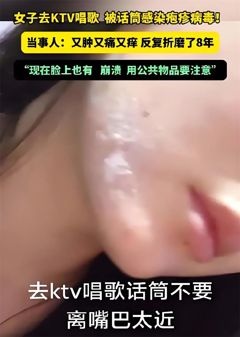 01.png